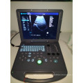 DW-C60 ultrasound echo laptop 3D machine